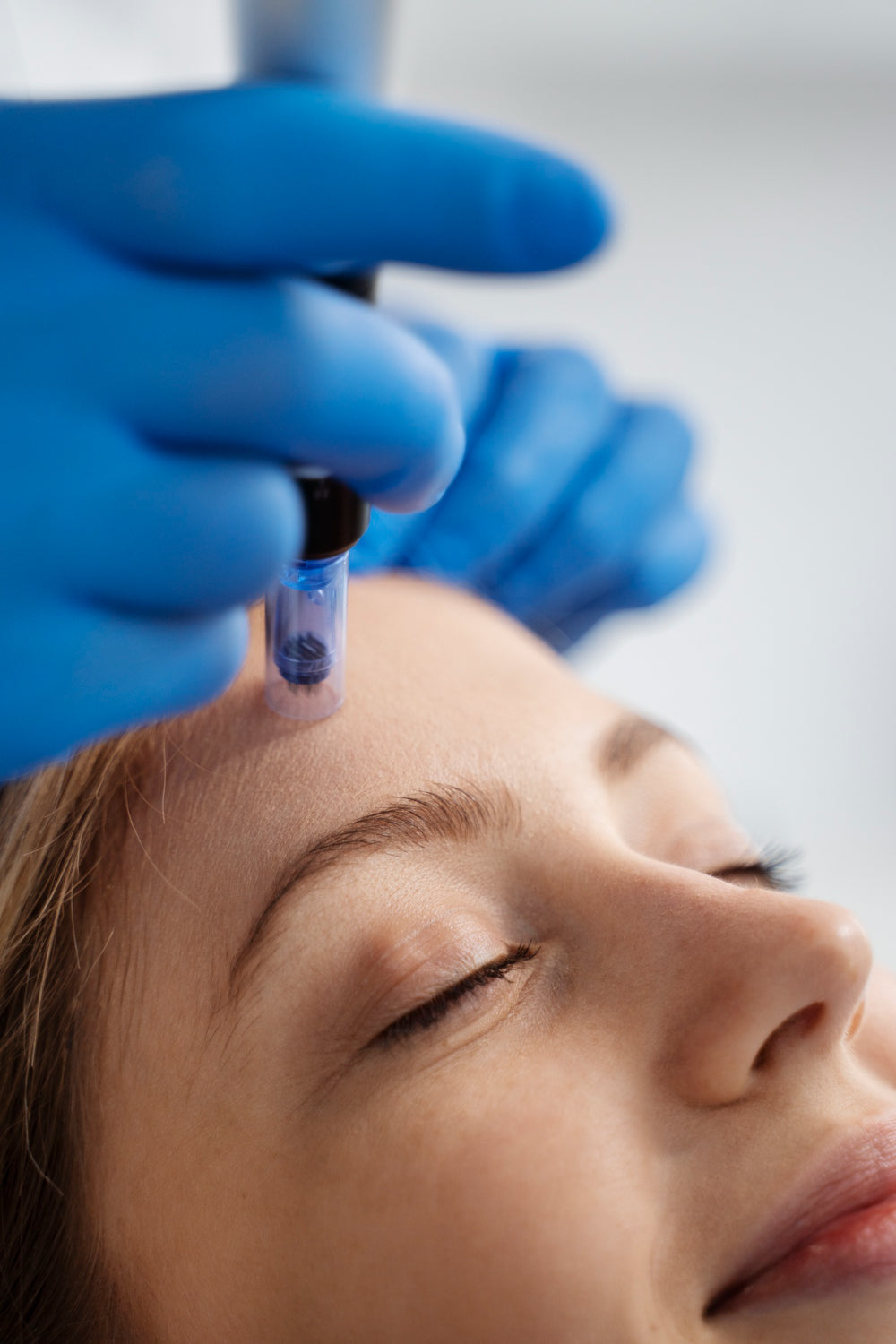 The Pure Derma Guide To Microneedling