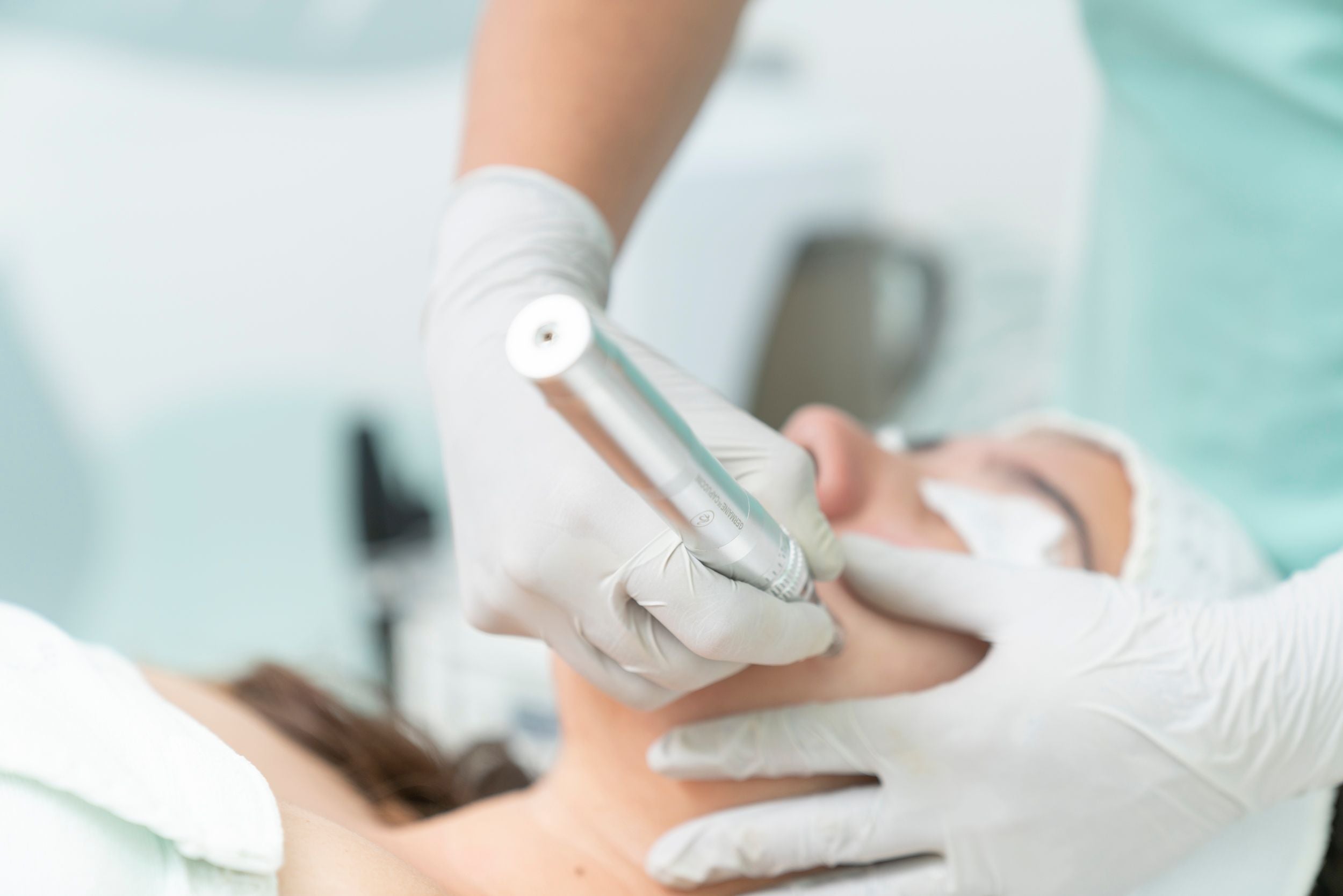 Gloved hands performing microneedling treatment on a client's face