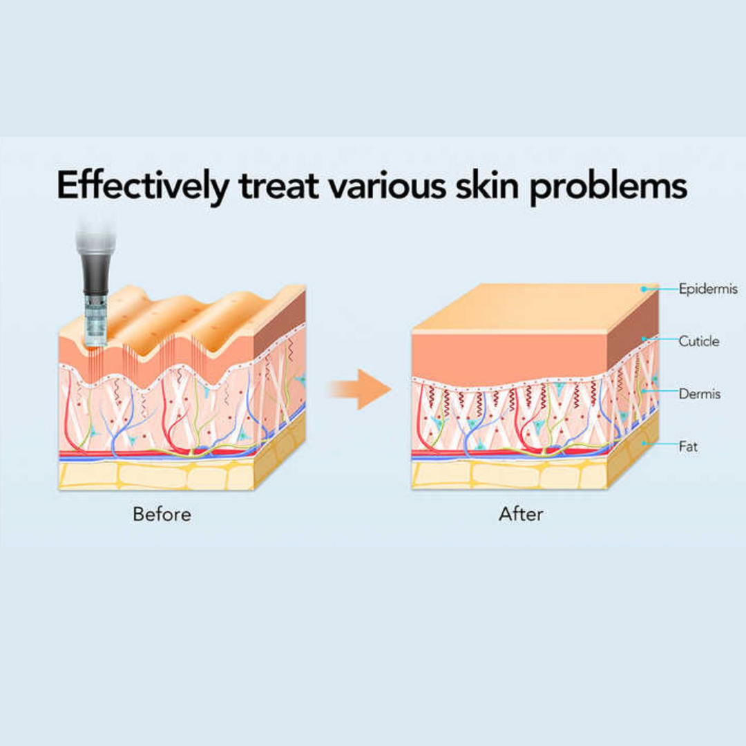 dr pen dermapen infographic