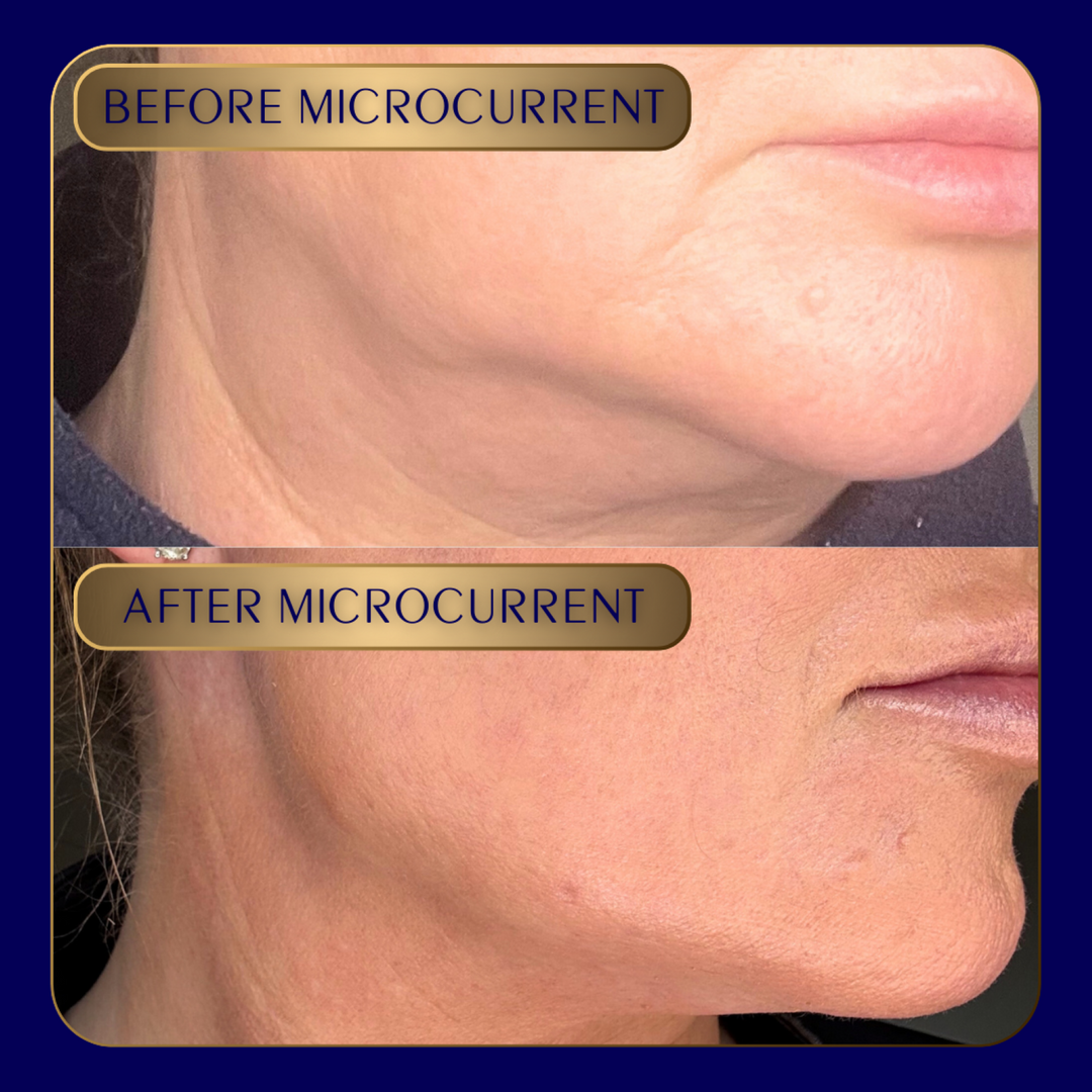 Advanced EMS Microcurrent Facial Toning Wand